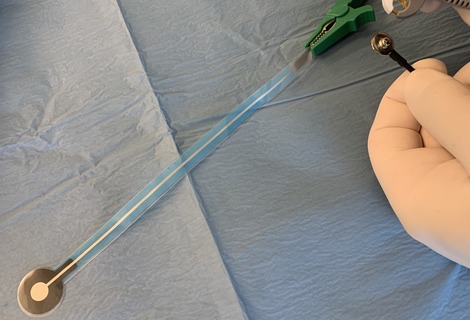 Heart Sense detects cardiac ischaemia better than standard ECG system