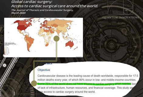 WORLD POPULATION ACCESS TO CARDIAC SURGERY