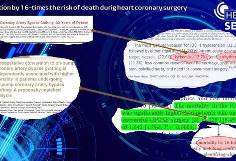 Reduction by 16-times the risk of death during heart coronary surgery / Heart Sense